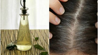 روش های درمانی سفید شدن موها