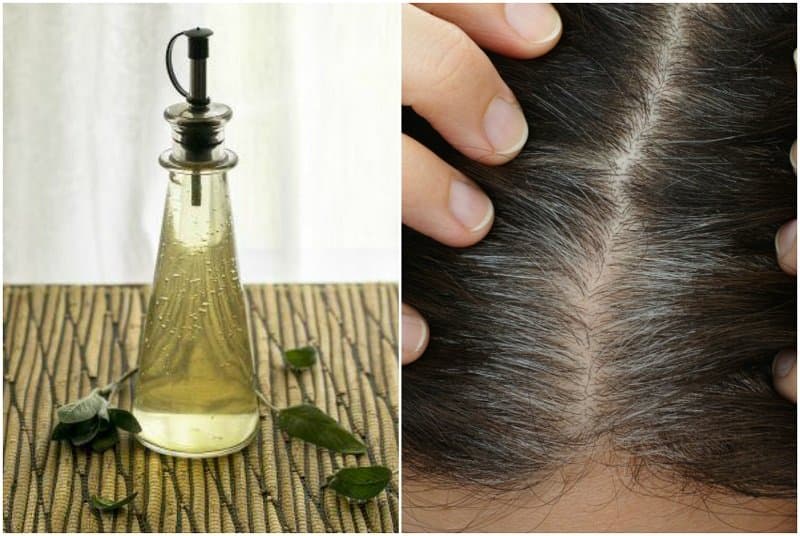 روش های درمانی سفید شدن موها